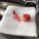 뉴연세보라매치과의원 네이버블로그