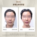 이유