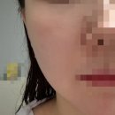 아이모드 | 홈모드 써마리프트 5주차 후기 ㅣ아이모드 후기|