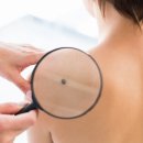 벨아미-리노보의원 이미지