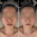 움트다 에스테틱 | 신부관리 마곡웨딩관리 마곡윤곽관리 • 움트다에스테틱 맞춤조각 리프팅 후기 예신관리추천 신부관리추천