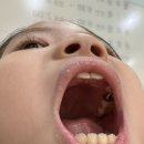 미소아치과치과의원 이미지