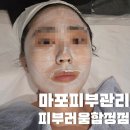 피부러움