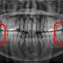 서울미라클치과의원 이미지