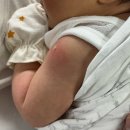 은하수방 | 부산 해운대 영유아검진, BCG 피내주사 해운대 ㅍㄹㅂㄷ어린이병원(딤플초음파..어안이벙벙..)