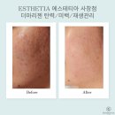 에스테티아사창