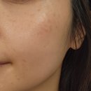 포커스 | 환절기 저속노화 루틴 동안크림과 하이포커스샷 후기