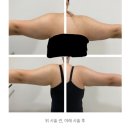 지힐링스퀘어의원 네이버블로그