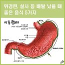 위경련, 설사 등 배탈 났을 때 좋은 음식 5가지 이미지