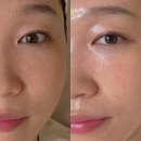 잠원동피부관리 슈퍼젝션 유명한 로지에스떼 강남 에스테틱 후기