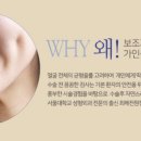 보조개1 이미지