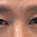 라이블리성형외과의원 이미지