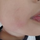 동탄미소소아청소년과의원 네이버블로그