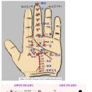 수지침 이미지