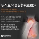 분당식도염치료 역류성 식도염 치료 후기 궁금하다면? 한방 자연치료와 관리법