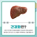 바른속내과 이미지