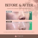 유리움한의원 | 실리프팅 잘하는곳 후기를 찾고 계신다면 이 글을 읽어보세요