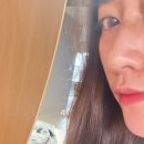 성남 위례 태평동 코필러 통증 붓기 내돈내산 리얼후기