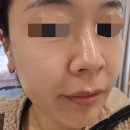 범천동 피부관리 플랜미에스테틱에서 수분관리 받고 온 후기
