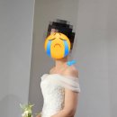 청량리 아비쥬에서 CO₂ 레이저 점 제거 일주일 후기!