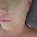 고운로(중로1-4) | [서산 피부관리 후기] 문제성 피부관리 전문 박앤이 피부관리실 PHA물톡스 필링 &amp; 여드름 압출