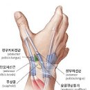 왼쪽 오른쪽 손목 통증 원인 방법 이미지