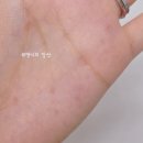킨텍스튼튼본의원 | 편평사마귀 제거 성지 서울 청량리 자연튼튼의원 예약 방문 후기 주차 꿀팁