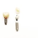 퍼즐치과기공소 이미지