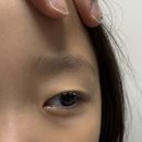 삼성굿아이안과의원 이미지