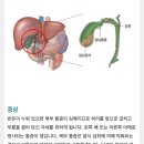 의학- 급성 췌장염 , 담낭염 논문 2자료 / 췌장암 진료 과정 / 이미지