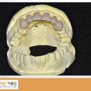 홍천치과기공소 이미지