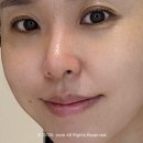 메디센스 | 환절기 PDRN 피부장벽회복크림 루아센시아 메디센스 CPR 크림 후기