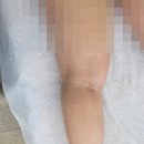 강서타워 앞 횡단보도(명지오션 3239-3) | 부산 강서구 명지피부관리 경력 20년차 화문에스테틱 운동 후 하체마사지