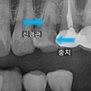 송정부부치과의원 | 송정역치과 찌릿 통증 수면으로 편안한 해결