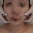 내돈내산 작은얼굴 만들어주는 청라 아르테라 에스테틱
