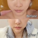 마두역6번출구 | 일산 마두역 피부관리 턴업에스테틱 에너지테라피 후기