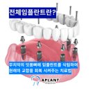 에이플란트치과의원 이미지