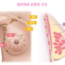 기통테라피 네이버블로그