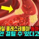 콜레스테롤 높으면 암에 걸릴까? 고지혈증약은 암을 예방할까? [스타틴의 진실] 이미지