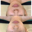 반송동071 | 동탄피부관리 [나음에스테틱]