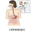 장상피화생 원인 진단 좋은 음식 이미지