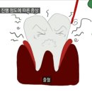 와이플란트치과 네이버블로그