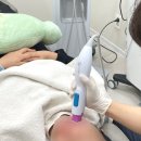 드림피부과의원 | 신사동써마지, 정품 확인 안 하면 후회합니다