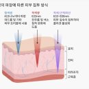 (주)썬에어로시스 | 화이트태닝 효과, 관리 방법 청주 위클리태닝 봉명점 후기