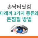 눈다래끼 (콩다래끼,속다래끼) 원인 전염 빨리 낫는법 이미지