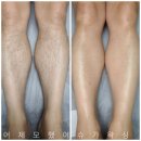어제모했어슈가왁싱