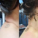 하나 의료기기 이미지