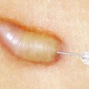 서울아트피부과의원 이미지