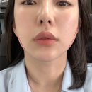 제이와이메디칼 이미지