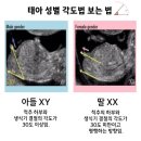 황실사과 | 임신초기 딸맘증상 7가지 (난황위치, 심장박동, 중국황실 달력, 각도법, 입덧과 입맛변화, 피부와 배모양)